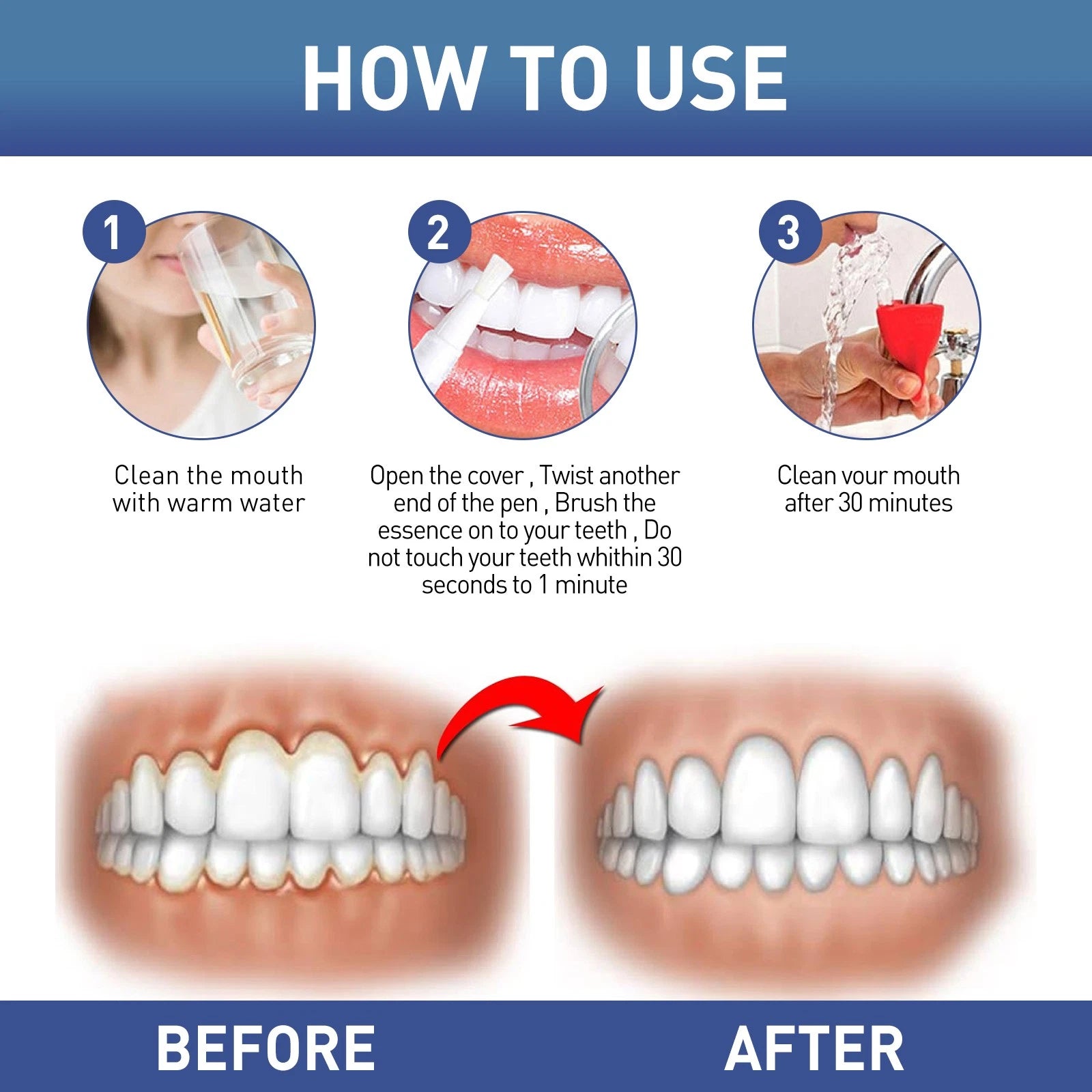 Gum Protect Repair Gel - Gum Instant Soothing Gel Receding Gums Therapy Inflammation Care Relief Gel